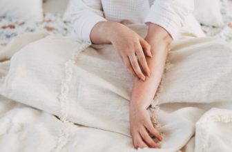 This Eczema Drug Just Got an FDA-Approved Upgrade
