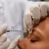 Best Tranexamic Acid, Alpha Arbutin, Kojic Acid & Azelaic Acid Serums & Creams for Pigmentation