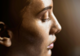 Radiesse May Be Tackling a Deeper Layer of Sun Damage, Study Finds