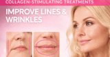 Looking for Subtle Facial Volume Restoration? 4 Ways Collagen-Stimulating Treatments Can Help