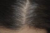 Why Are Grey Hairs Thicker Than Normal Hairs?