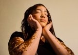 Vitiligo Affects More Than Skin, a New Survey Finds