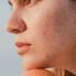 Hollow Temples Can Age You—Here’s How to Reverse Them