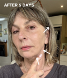 I’m Pro-Ageing But My Neck Hasn’t Had The Memo (+ a v. good ZIIP Halo Offer & Discount) #ad